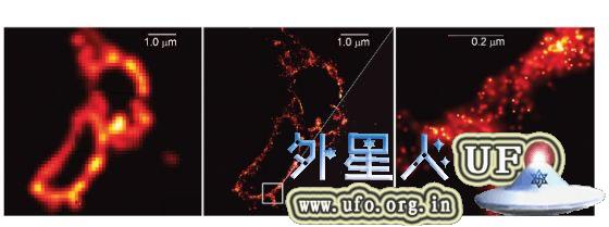 图5：中间图像为溶酶体膜（lysosome membranes），是埃里克•白兹格（Eric Betzig）首次使用单分子显微镜拍摄的图片之一。从中选取0.2微米的阿贝衍射极限大小显示在右边。左边为用传统显微镜拍摄的图片，可以看出图片分辨率提高了很多倍。 第5张