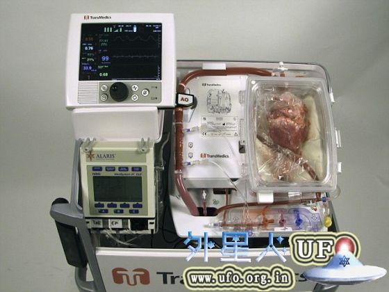 悉尼圣文森特医院的医生运用澳大利亚开发的心脏复跳控制台和保存液为患者移植死了的心脏。 第1张